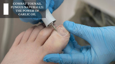 Combat Toenail Fungus Naturally: The Power Of Garlic Oil