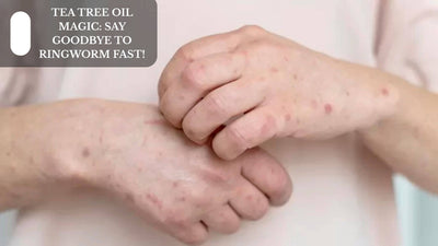 Tea Tree Oil Magic: Say Goodbye To Ringworm Fast!